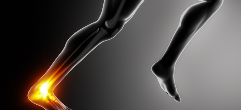 Osteopathy for Achilles Injuries